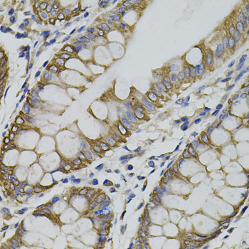 ARHGEF11 Rabbit polyclonal antibody