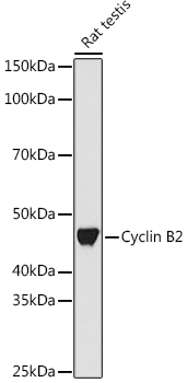 Cyclin B2 Rabbit monoclonal antibody