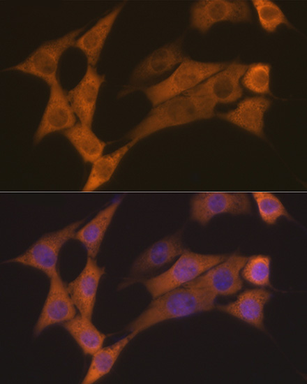 Cyclin B2 Rabbit monoclonal antibody