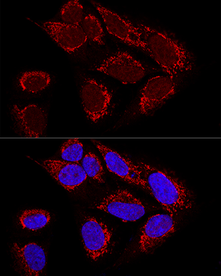 MTX2 Rabbit polyclonal antibody