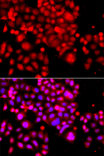 ASCC3 Rabbit polyclonal antibody