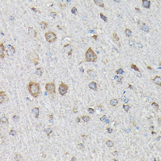 MTHFD1L Rabbit polyclonal antibody