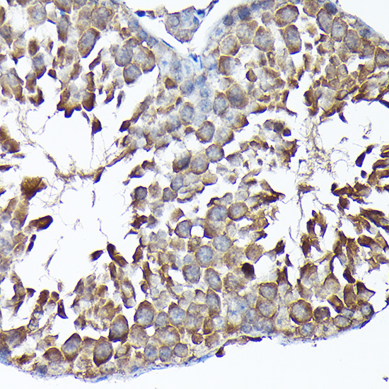 MTHFD1L Rabbit polyclonal antibody