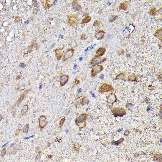 MTHFD1L Rabbit polyclonal antibody