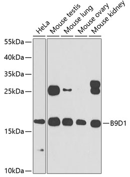 B9D1 Rabbit polyclonal antibody