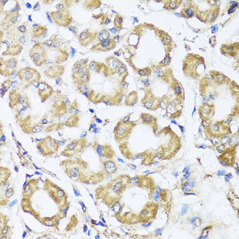 B9D1 Rabbit polyclonal antibody