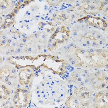 B9D1 Rabbit polyclonal antibody