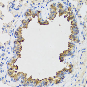 B9D1 Rabbit polyclonal antibody
