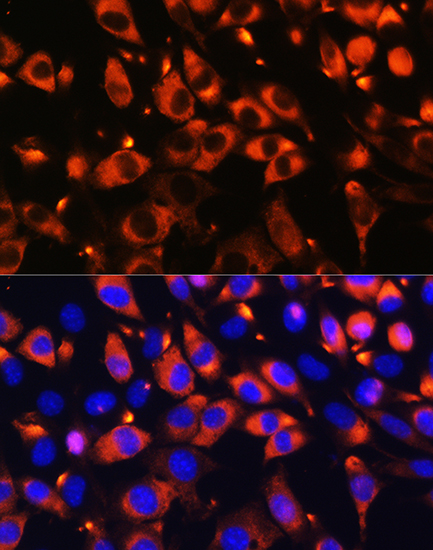 B9D1 Rabbit polyclonal antibody