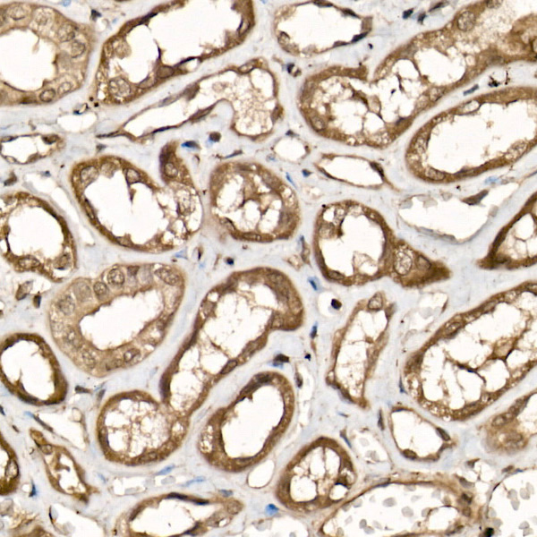 UCHL5 Rabbit polyclonal antibody