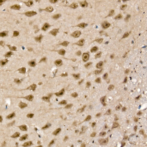 UCHL5 Rabbit polyclonal antibody