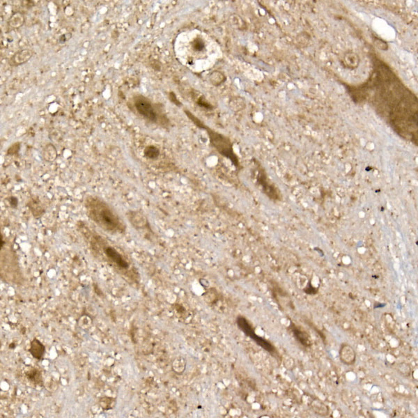 UCHL5 Rabbit polyclonal antibody
