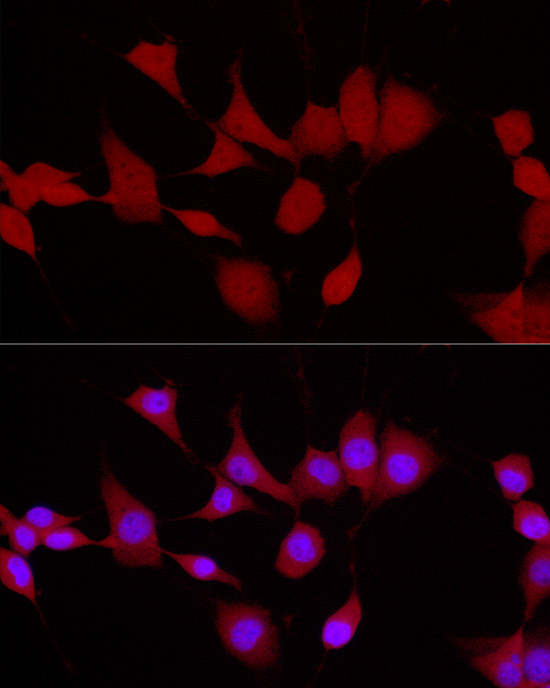 UCHL5 Rabbit polyclonal antibody