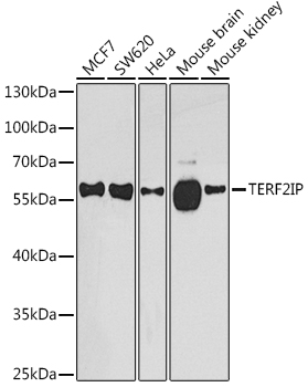 TERF2IP Rabbit polyclonal antibody