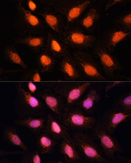 TERF2IP Rabbit polyclonal antibody