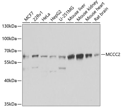 MCCC2 Rabbit polyclonal antibody