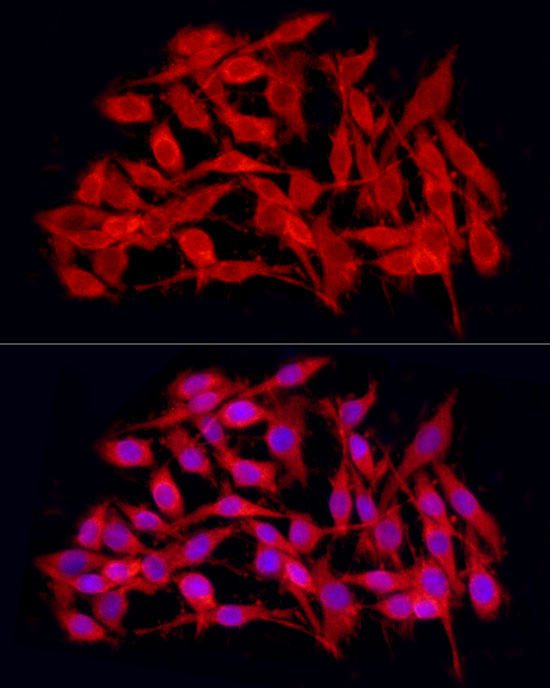 JMJD4 Rabbit polyclonal antibody