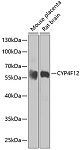 Western blot - CYP4F12 Rabbit pAb (A7993)