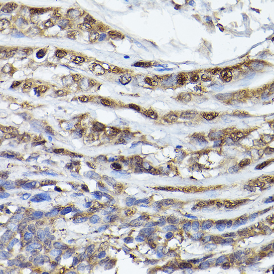 PHD3 Rabbit polyclonal antibody