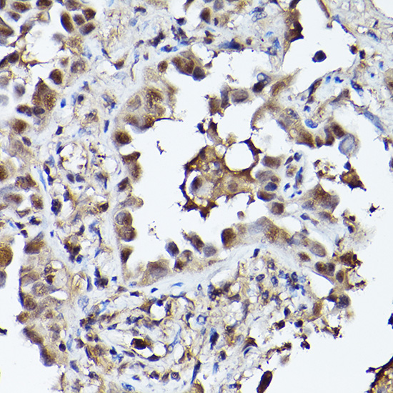 PHD3 Rabbit polyclonal antibody