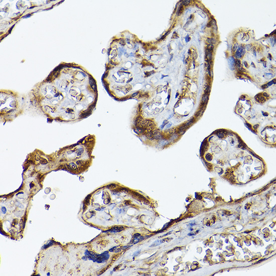 PHD3 Rabbit polyclonal antibody