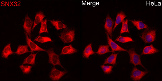 SNX32 Rabbit polyclonal antibody