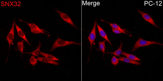 SNX32 Rabbit polyclonal antibody