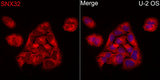 SNX32 Rabbit polyclonal antibody