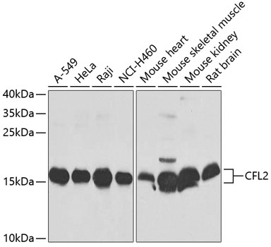 CFL2 Rabbit polyclonal antibody