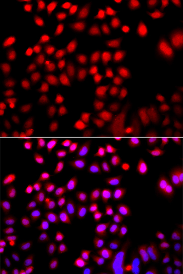 CFL2 Rabbit polyclonal antibody