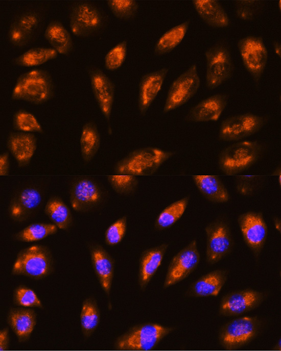 GRID1 Rabbit polyclonal antibody