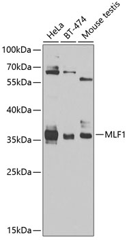 MLF1 Rabbit polyclonal antibody