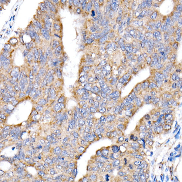 NDUFV1 Rabbit polyclonal antibody
