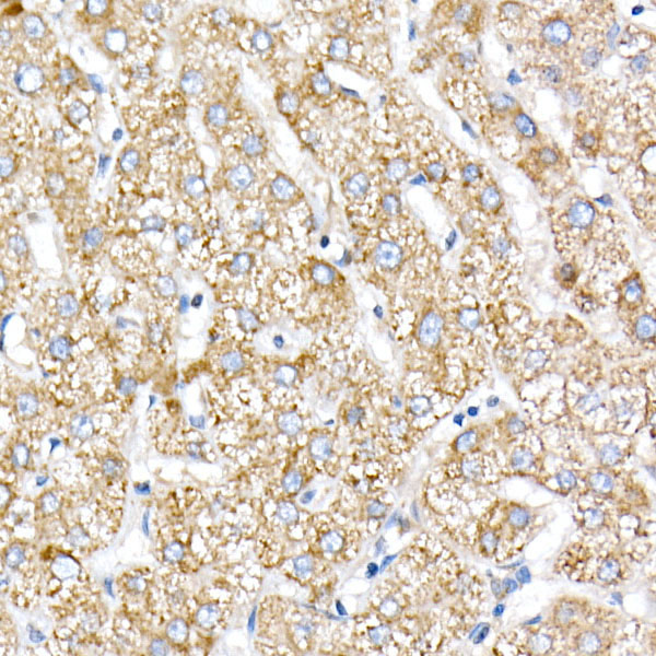 NDUFV1 Rabbit polyclonal antibody