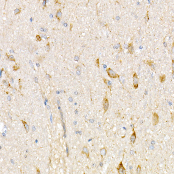 NDUFV1 Rabbit polyclonal antibody