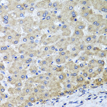 OSGEPL1 Rabbit polyclonal antibody