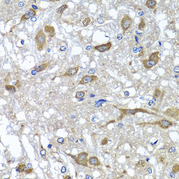 OSGEPL1 Rabbit polyclonal antibody