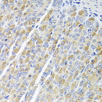 OSGEPL1 Rabbit polyclonal antibody