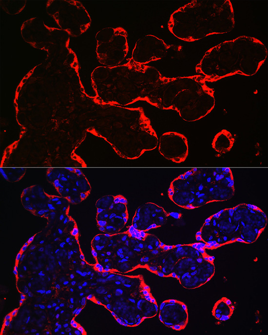HSD3B1 Rabbit polyclonal antibody