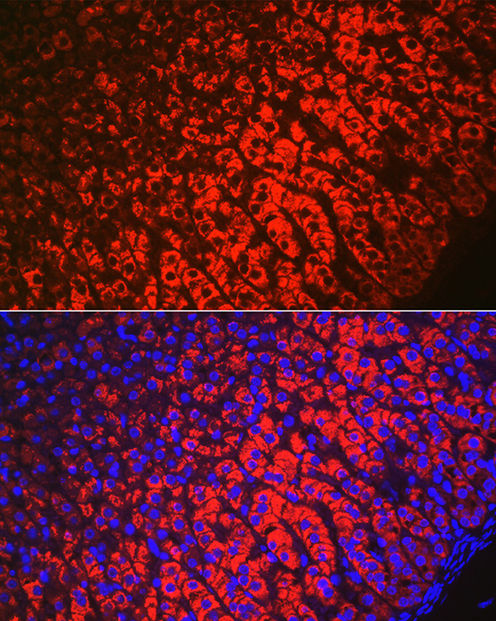 HSD3B1 Rabbit polyclonal antibody