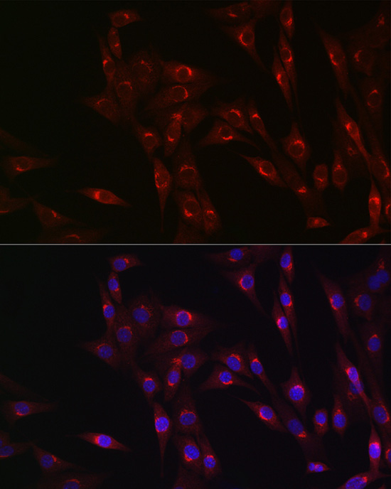 MR1 Rabbit polyclonal antibody