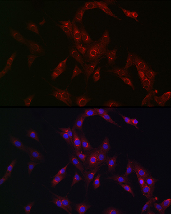 MR1 Rabbit polyclonal antibody