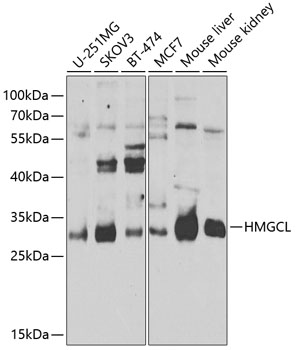 HMGCL Rabbit polyclonal antibody