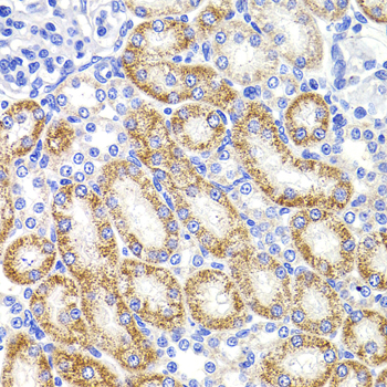 HMGCL Rabbit polyclonal antibody