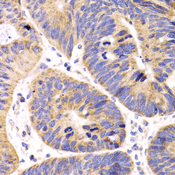 HMGCL Rabbit polyclonal antibody