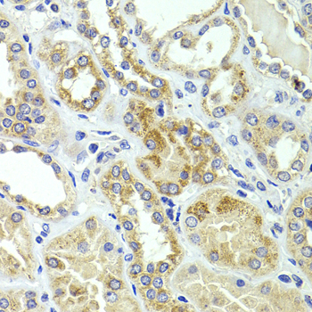 HMGCL Rabbit polyclonal antibody