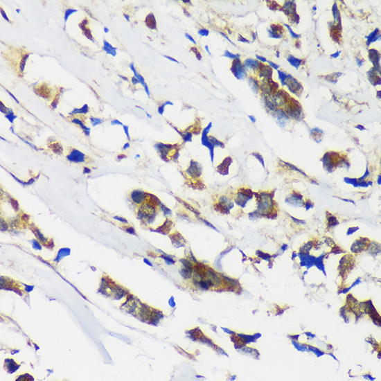 MBNL1 Rabbit polyclonal antibody