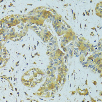 MTCH1 Rabbit polyclonal antibody