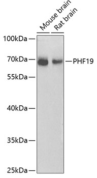 PHF19 Rabbit polyclonal antibody