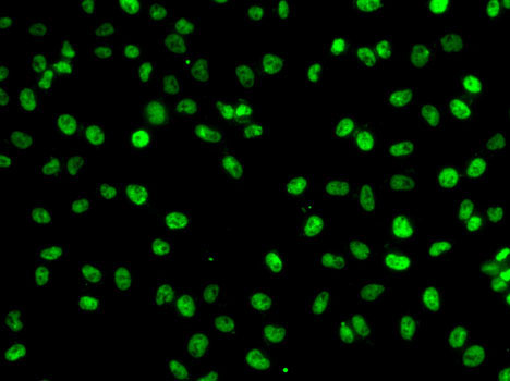 PHF19 Rabbit polyclonal antibody
